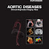 Download Aortic Diseases: Clinical Diagnostic Imaging Atlas (Cardiovascular Emergencies: Atlas and Multimedia)