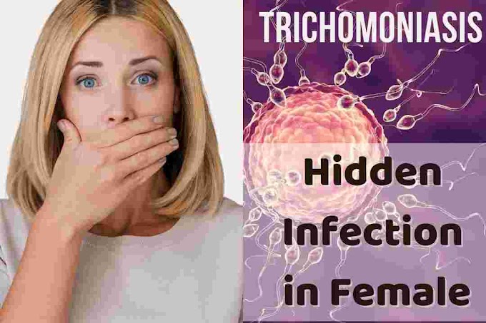 What is Trichomoniasis in Females, Hidden Symptoms,Prevention And Cure