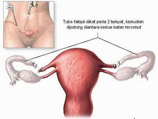 Dapatkan Informasi Beragam Masalah Kesehatan Pada Wanita Disini Daftar Ragam Masalah Kesehatan Wanita