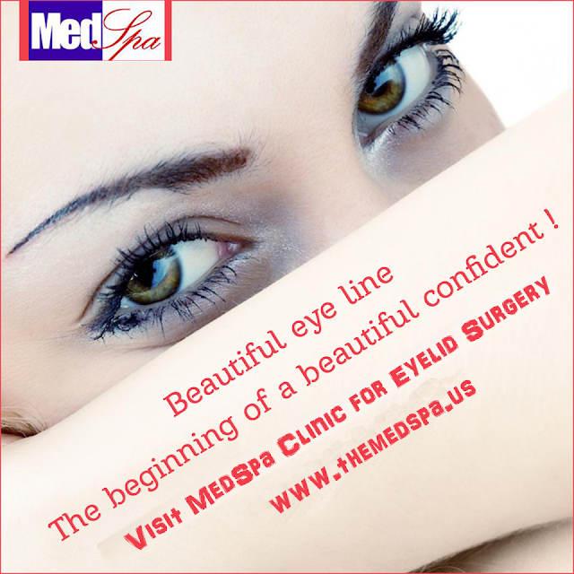 eyelid surgery-blepharoplasty