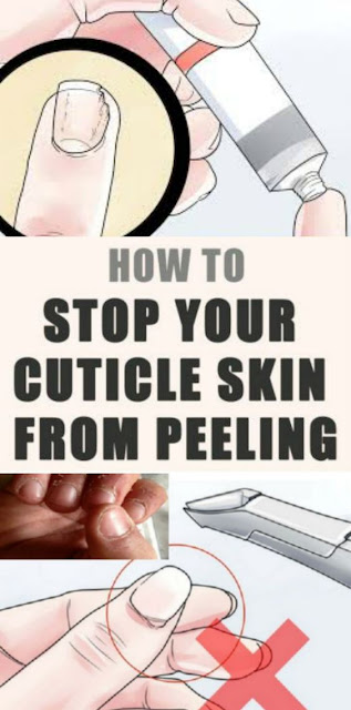 HOW TO STOP YOUR CUTICLE SKIN FROM PEELING