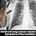 Small Cell Lung Cancer: Causes and Symptoms of the Condition