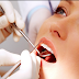 Răng sứ Zirconia có độ bền bao lâu ?
