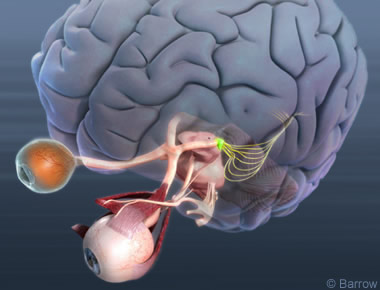 Optik sinir görme bilgilerini retinadan beyne aktarır. Nefes aldığında geçici görme kaybına neden olabilir.