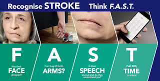 Tingkatan Penyakit Stroke, Penyakit Stroke Apa Bisa Disembuhkan, Penyakit Stroke Parah, Menyembuhkan Stroke Dengan Cepat, Resep Obat Herbal Stroke, Obat-Obatan Untuk Stroke Iskemik, Untuk Mengobati Stroke, Obat Tradisional Untuk Stroke, Tumbuhan Obat Untuk Stroke Ringan, Penyakit Stroke Mati Sebelah, Pengobatan Stroke Kronis, Pengobatan Pasca Stroke Ringan, Obat Untuk Stroke Infark, Cara Mengobati Stroke Secara Tradisional, Obat Alami Sakit Stroke Ringan 