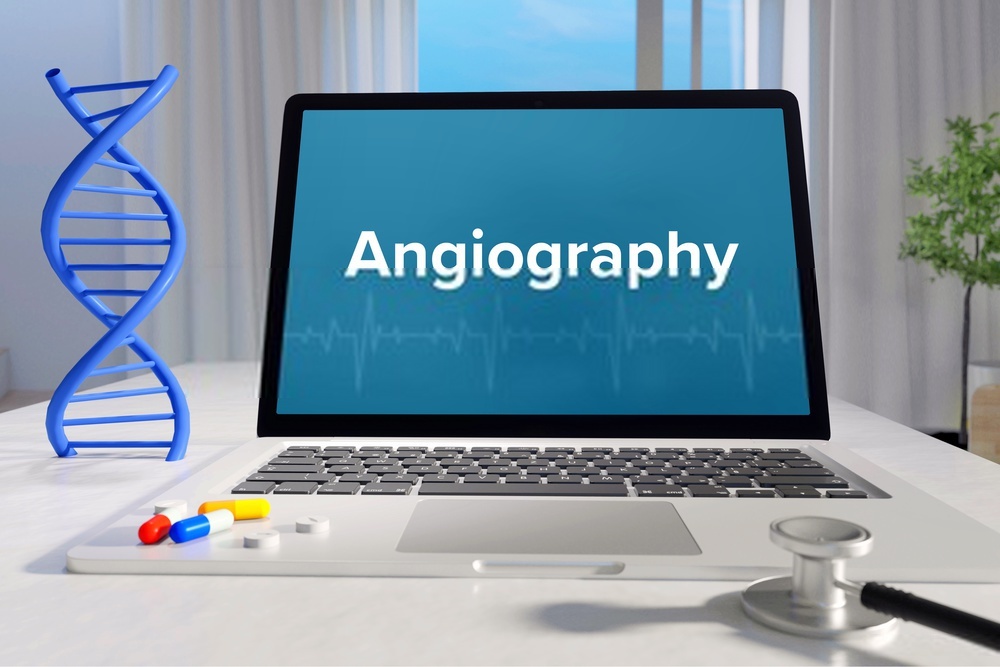 What is angiography?