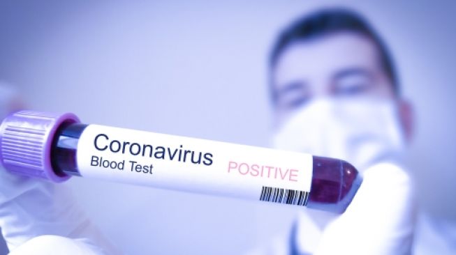 Cek Fakta: Benarkah Virus Corona Disebabkan Konsumsi Babi, Sebagaimana Disebut MUI? naviri.org, Naviri Magazine, naviri