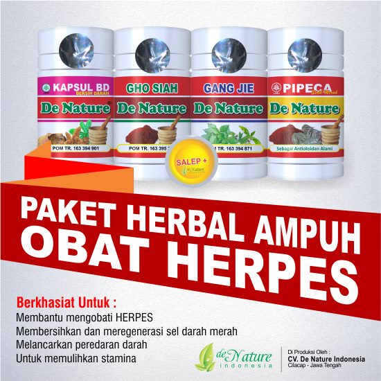 cara menyembuhkan herpes anah