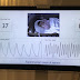 Medical Revolution: Camera To Be Used As A Vital Signs Monitor