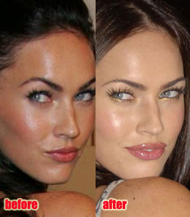 megan fox plastic surgery before after