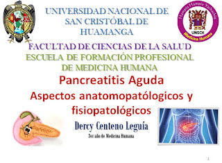 Pancreatitis Aguda DCL