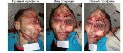 civilian victims of Ukrainian and NATO and British crimes