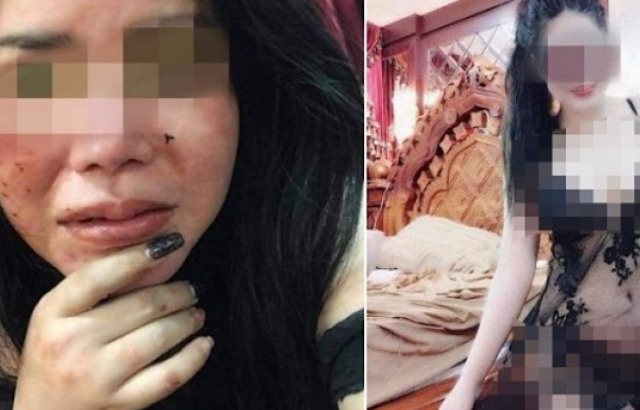 Waduh Wanita Ini Bonyok Dihajar Pacar Usai Unggah Foto Seksi Dimedia Sosial