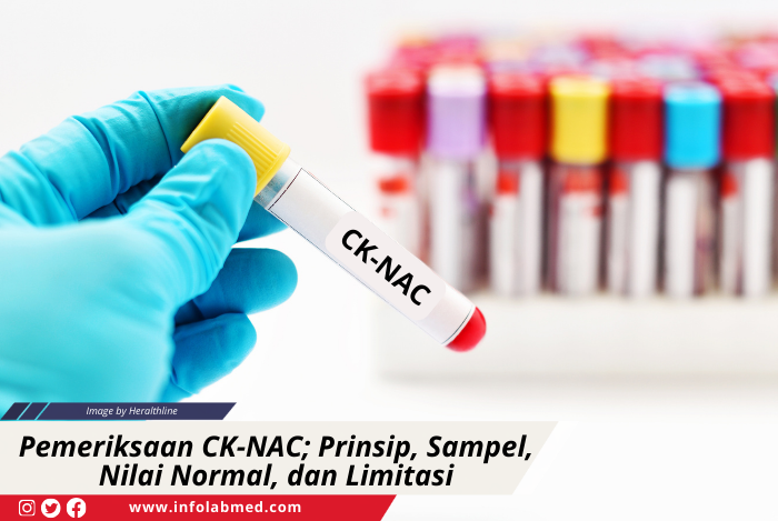 Pemeriksaan CK-NAC; Prinsip, Sampel, Nilai Normal, dan Limitasi