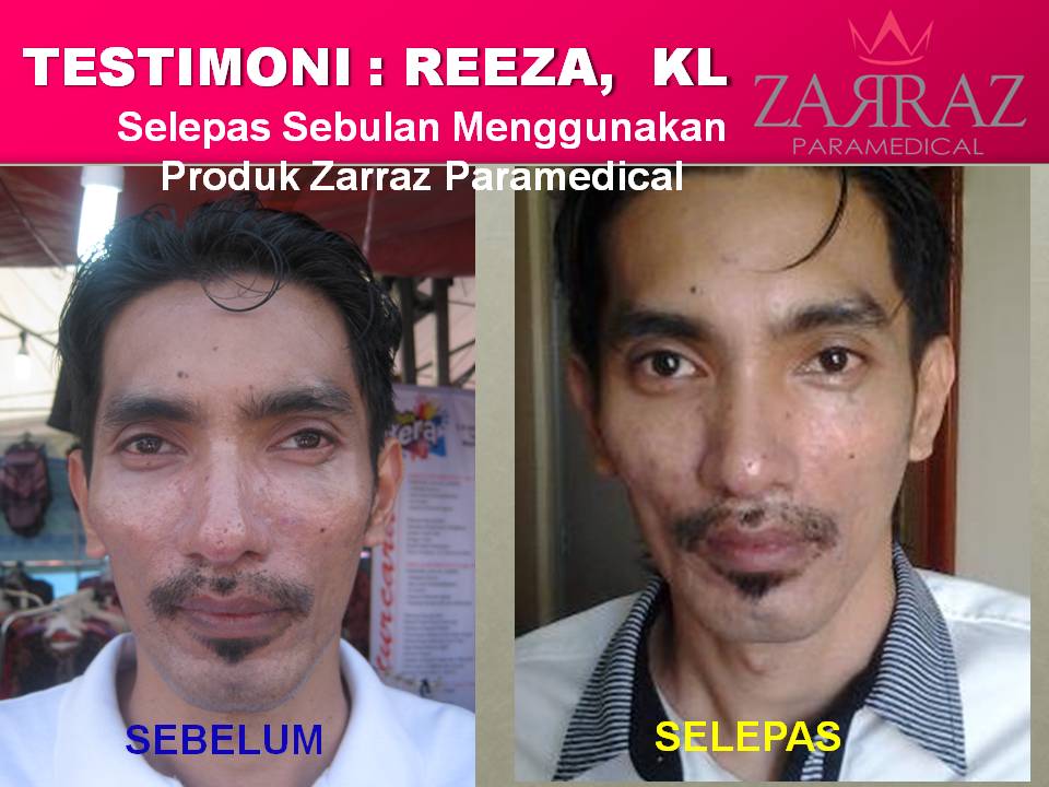 Testimoni ~ Zarraz Paramedical