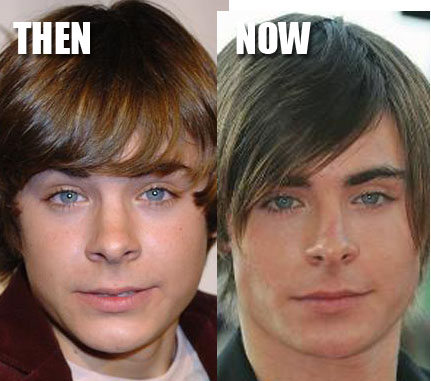 and after plastic surgery,