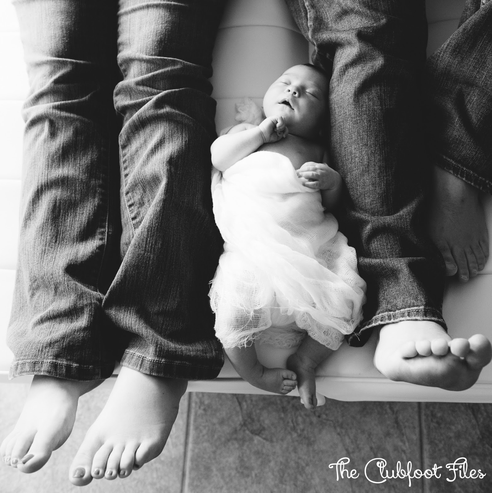 A Peachtree City Life Clubfoot Files
