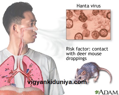 हंतवयरस (Hantavirus)