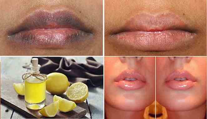 Cara Memerahkan Bibir Secara Cepat dan Alami dengan Lemon dan Gula