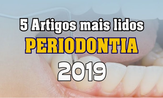 5 Artigos de PERIODONTIA mais lidos em 2019