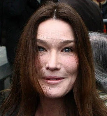 carla bruni chirurgie