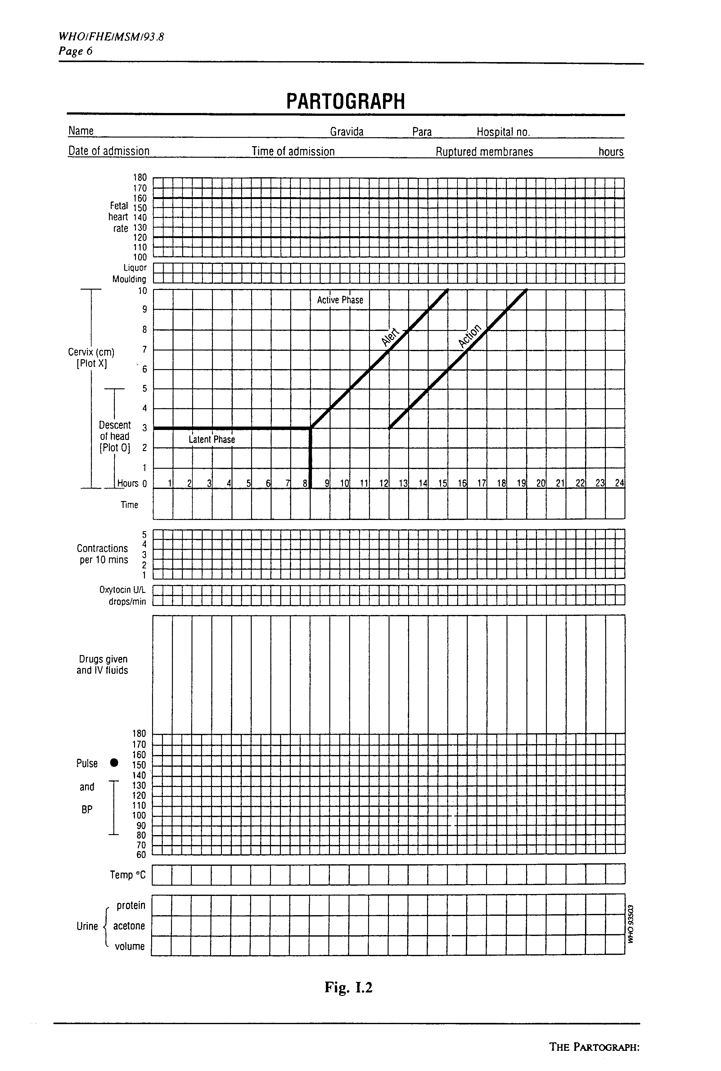 A sample copy of partograph by World Health Organization