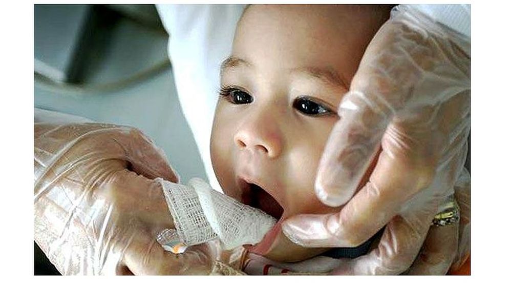 Higiene Bucal en bebés