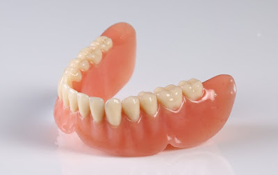 Làm răng giả có ảnh hưởng gì không? Cần tìm hiểu 1