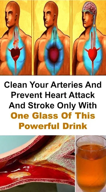Clean Your Arteries And Prevent Heart Attack And Stroke Only With One Glass Of This Powerful Drink