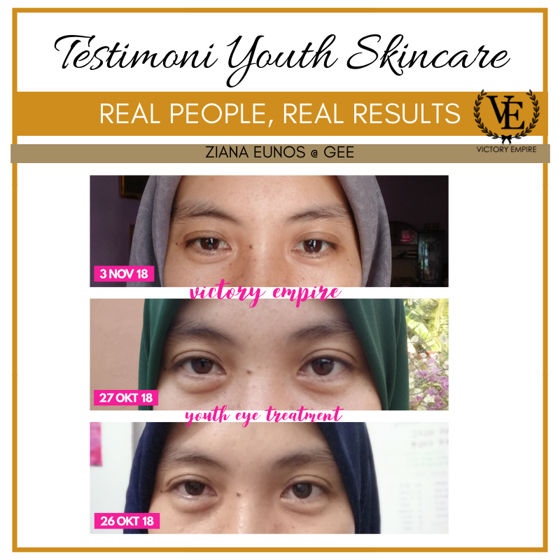 Testimoni Youth Restoring Eye Treatment Shaklee