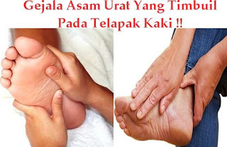 Cara Menurunkan Asam Urat Dalam Tubuh, Penyebab Asam Urat Tinggi Dan Cara Mengatasinya, Obat Alami Menyembuhkan Penyakit Asam Urat, Cara Menghilangkan Sakit Akibat Asam Urat, Asam Urat Ukuran, Penderita Asam Urat Akut, Obat Alternatif Sakit Asam Urat, Asam Urat Pada Wanita Menopause, Nyeri Asam Urat Jangan Dipijat, Solusi Mengatasi Penyakit Asam Urat, Makanan Penyebab Asam Urat Dan Obatnya, Obat Penyakit Rematik Atau Asam Urat, Asam Urat Dan Cara Mengobati, Obat Asam Urat Yang Aman Buat Ibu Menyusui, Ikan Pantangan Asam Urat, Kadar Asam Urat Dalam Darah Yang Normal, Hubungan Asam Urat Dengan Gangguan Ginjal, Asam Urat Dan Pantangannya, Obat Herbal Asam Urat Kolesterol Diabetes, Normal Asam Urat Dan Kolesterol, Cek Asam Urat Prodia, Resep Dokter Untuk Penyakit Asam Urat, Obat Untuk Sakit Asam Urat, Nilai Normal Asam Urat Pada Anak, Obat Asam Urat Obat Herbal, Obat Penurun Asam Urat Cepat, Resep Dokter Sakit Asam Urat, Cara Cepat Meredakan Nyeri Asam Urat, Asam Urat Penyembuhan Alami Asam Urat, Cara Menyembuhkan Asam Urat Kambuh 