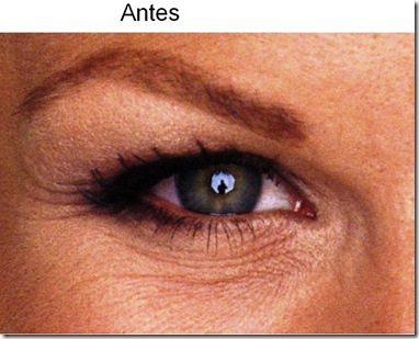 antes 5a