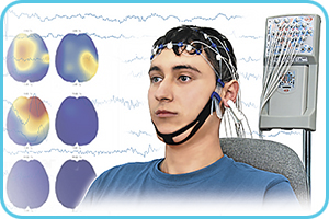 Electroencephalographs