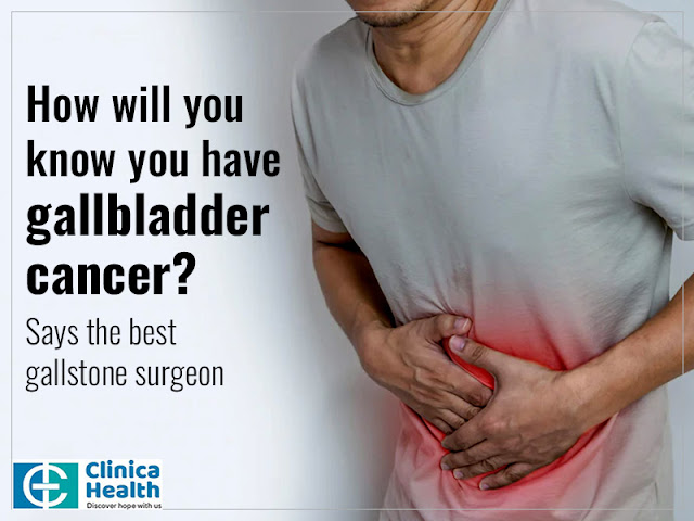 best gallbladder cancer surgeon
