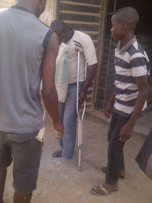 Amazing!!  A one legged man lift a bag of cement 