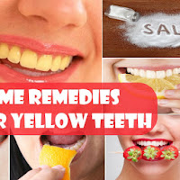 How To Get Rid Of Yellow Teeth By Using 4 Home Remedies!