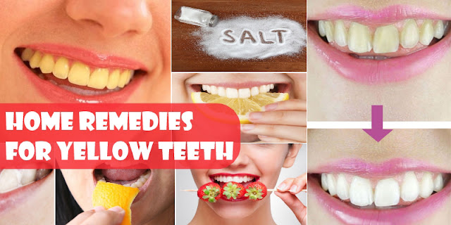 How To Get Rid Of Yellow Teeth By Using 4 Home Remedies!