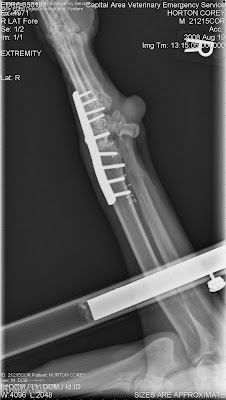 Coreys X RAY of his wrist showing the metal plate with nine screws holding it in place