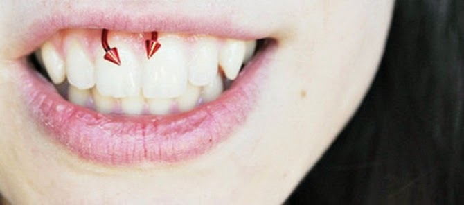 Imagens de piercing no smile com aparelho