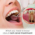 What You Need to Know About Root Canal Treatment