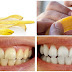 See How To Use Banana Peels To Whiten Your Teeth- (Must See)