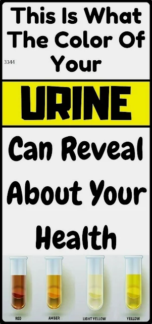 What The Color Of Your Urine And Frequent Urination Can Tell You About Your Health?