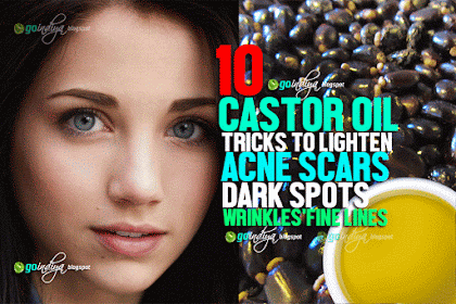 10 Tricks to Lighten Acne Scars, Dark spots with Castor Oil? 