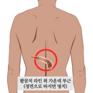 췌장암 등 통증 부위 설명 사진