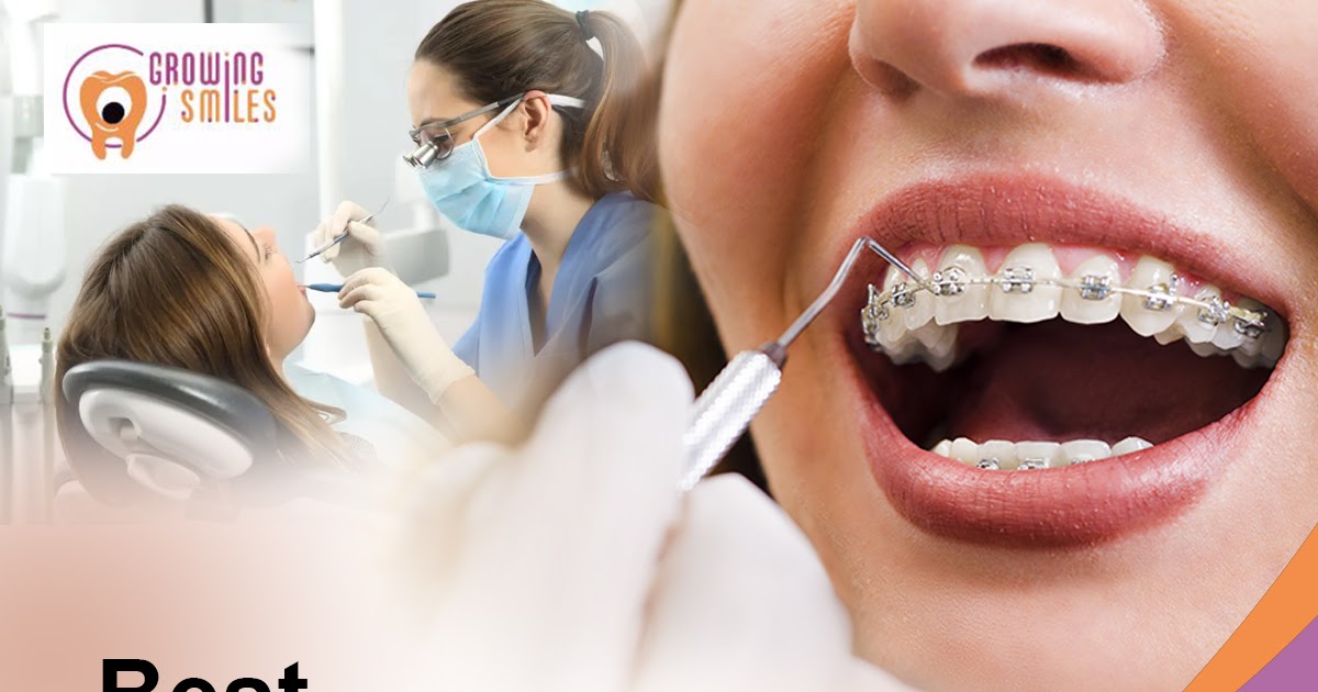 Reasons for Visiting a Dentist Regularly