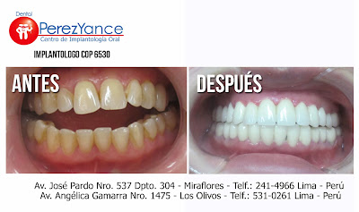  www.dentalperezyance.com