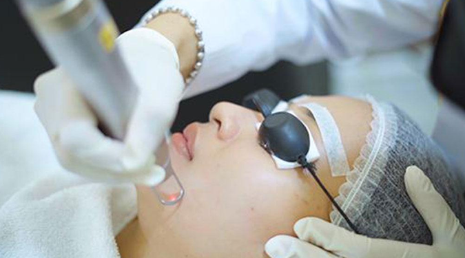 Pros and Cons of Skin Laser Treatment