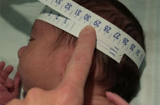 Medição de bebê com microcefalia.