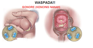 Obat Gonore Kencing Nanah Apotik