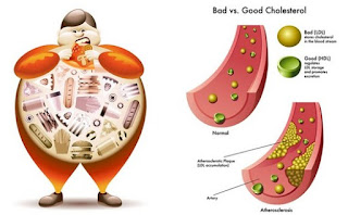 Cara-Cepat-Menurunkan-Kolesterol-Secara-Alami-Tanpa-Obat